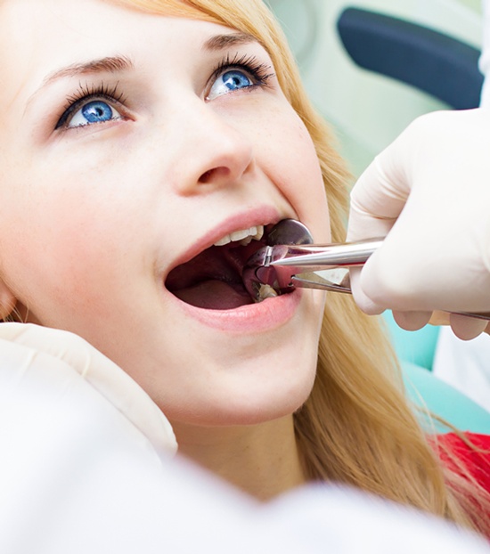 wisdom teeth extraction Oakville