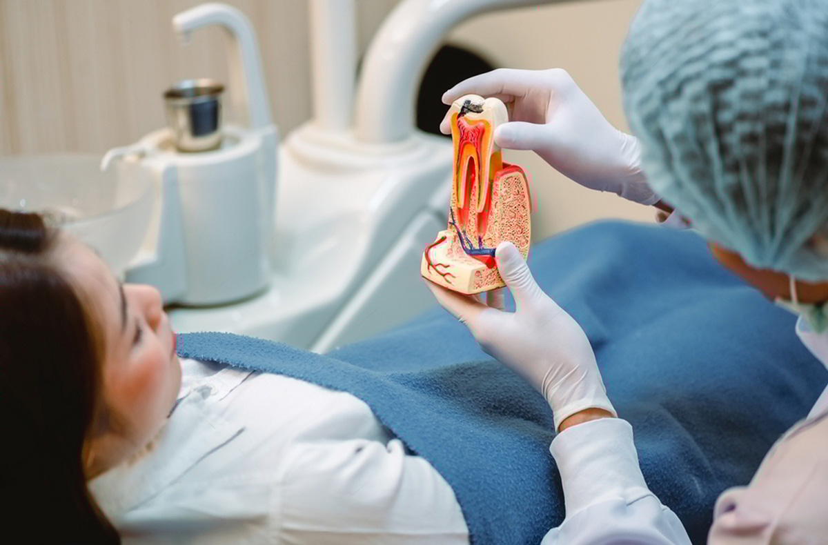 root canal Oakville